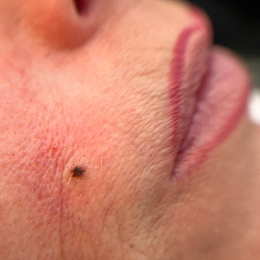 beautyspot PMU
moedervlek PMU
beautyspot laten zetten
moedervlek laten zetten
PMU beautyspot Overveen
PMU beautyspot Haarlem
beautyspot semi-permanent
moedervlek semi-permanent
natuurlijke beautyspot PMU
subtiele beautyspot PMU
beautyspot op maat laten zetten
beautyspot behandeling Overveen
PMU moedervlek salon
beautyspot correctie PMU
kleine moedervlek PMU
beautyspot pigmentatie
PMU moedervlek specialist Haarlem
beautyspot permanent make-up
natuurlijke moedervlek PMU Overveen
PMU beautys