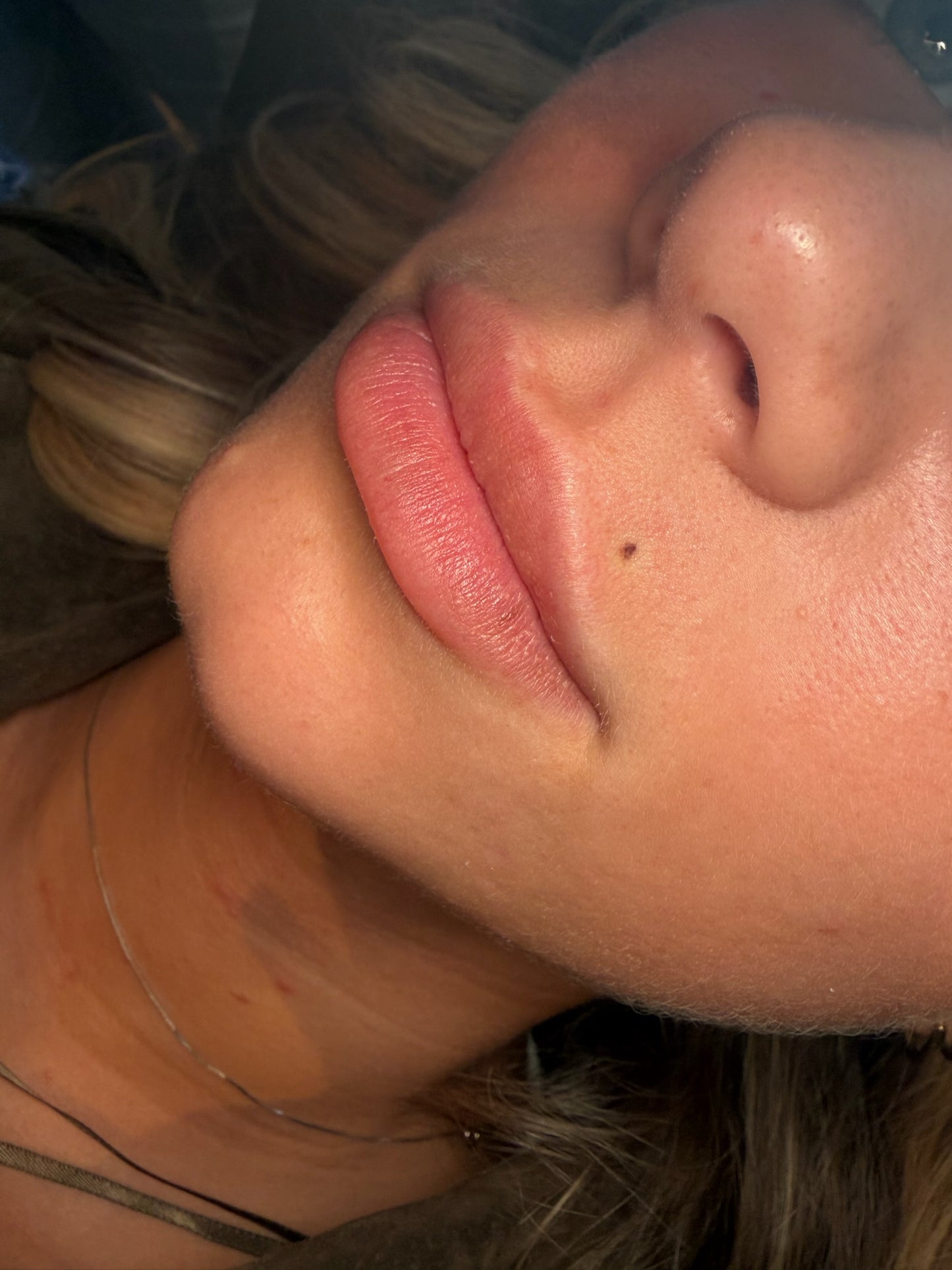 Beauty spot